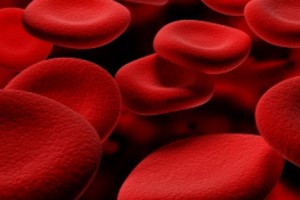 Anemia es una enfermedad en la que la sangre